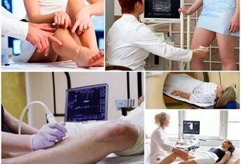 Varicose veins varicose veins methods