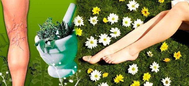 Folk remedies for varicose veins in the legs, contributing to a quick recovery