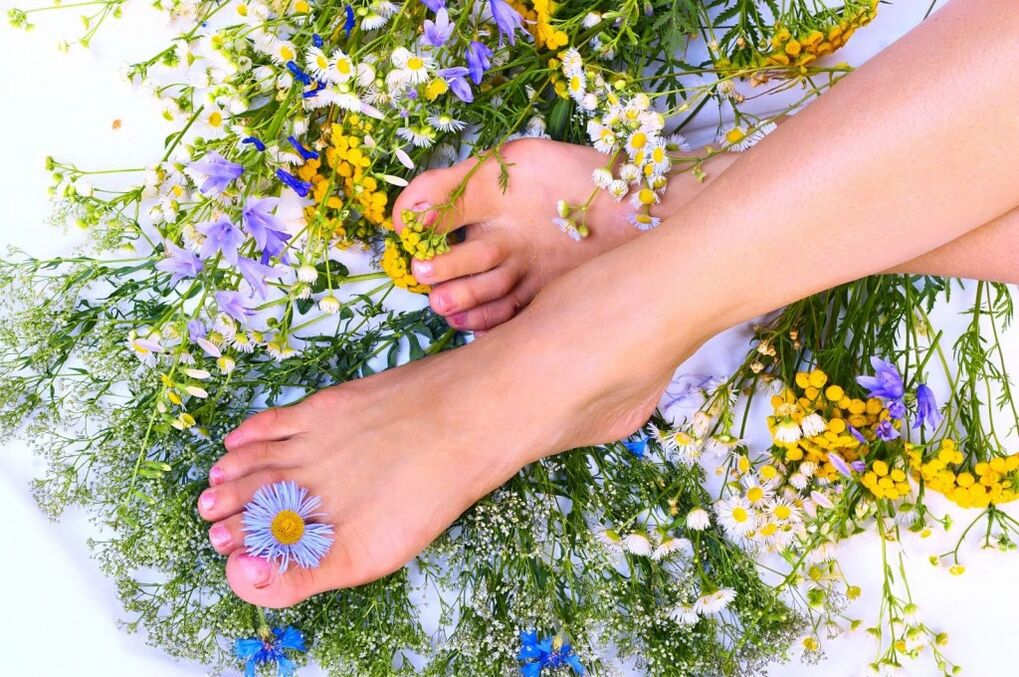 Varicose veins