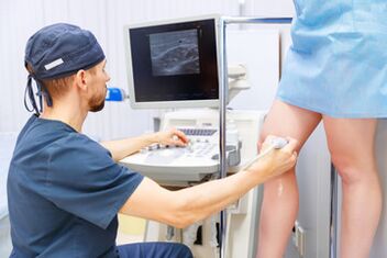 varicose veins diagnosis